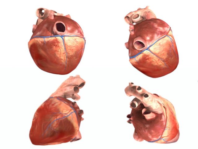 Herzerkrankungen Quicktime-VR