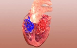 Animation Blutfluss Kreislaufsysteme Herz