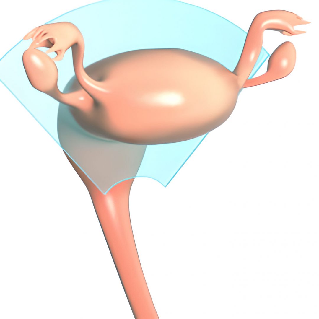 ultraschall gebaermutter