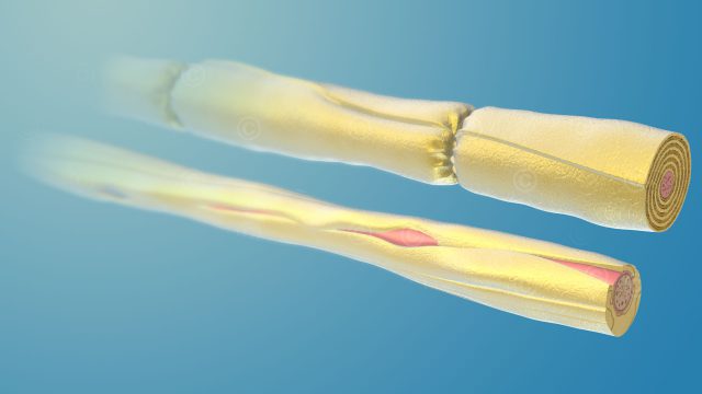 Types of nerve fibers