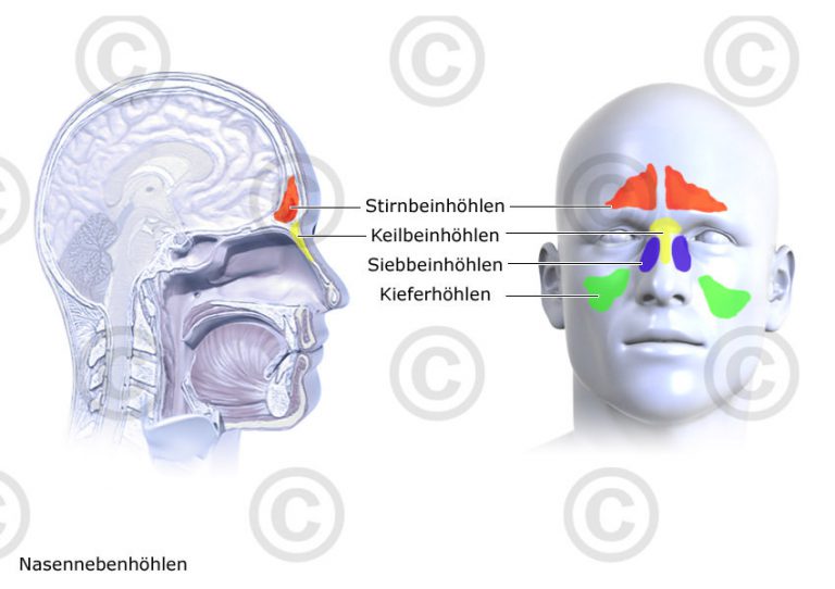 Illustration Nasennebenhöhlen MedicalGraphics