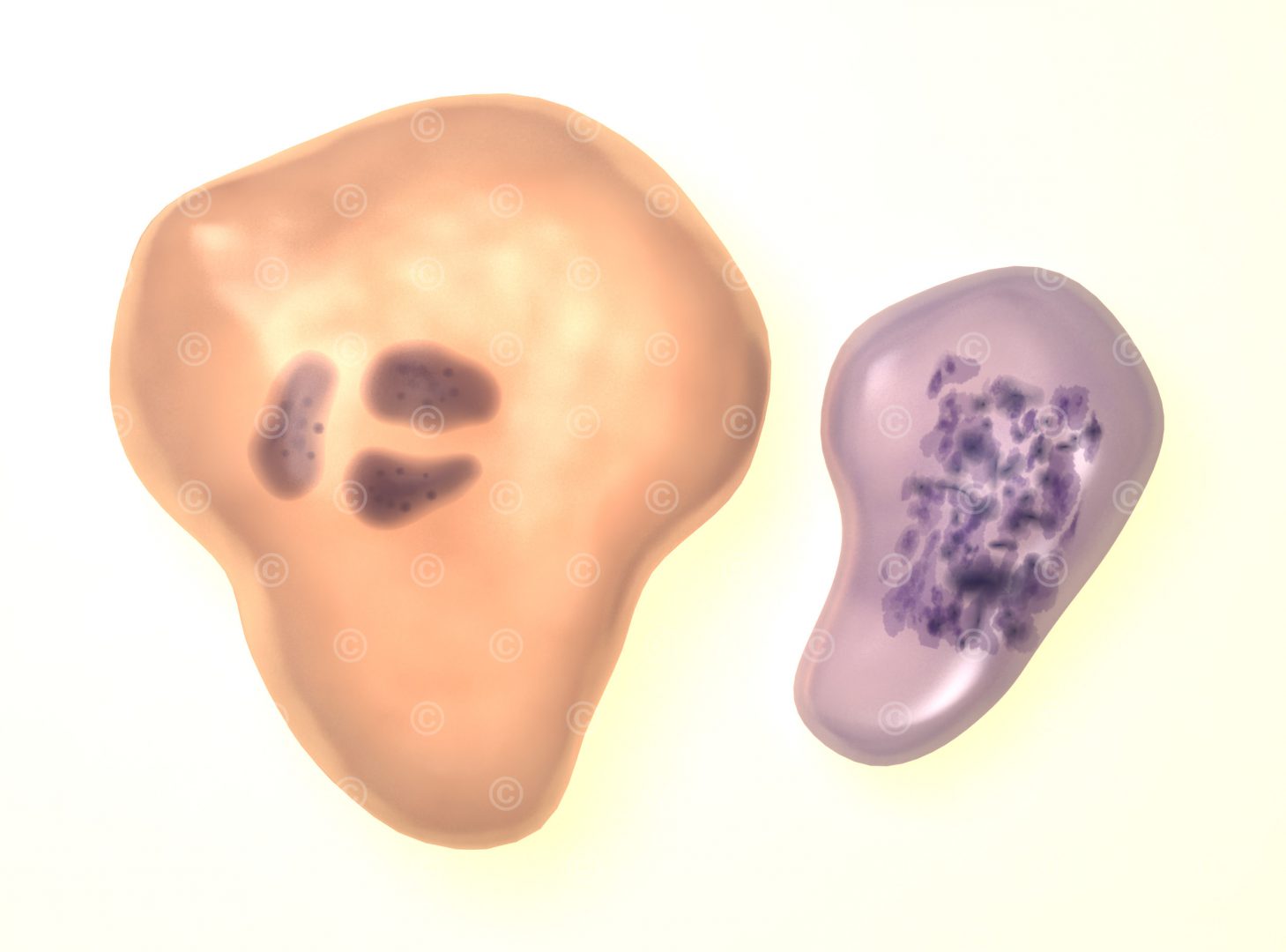 Zellveränderung HPV