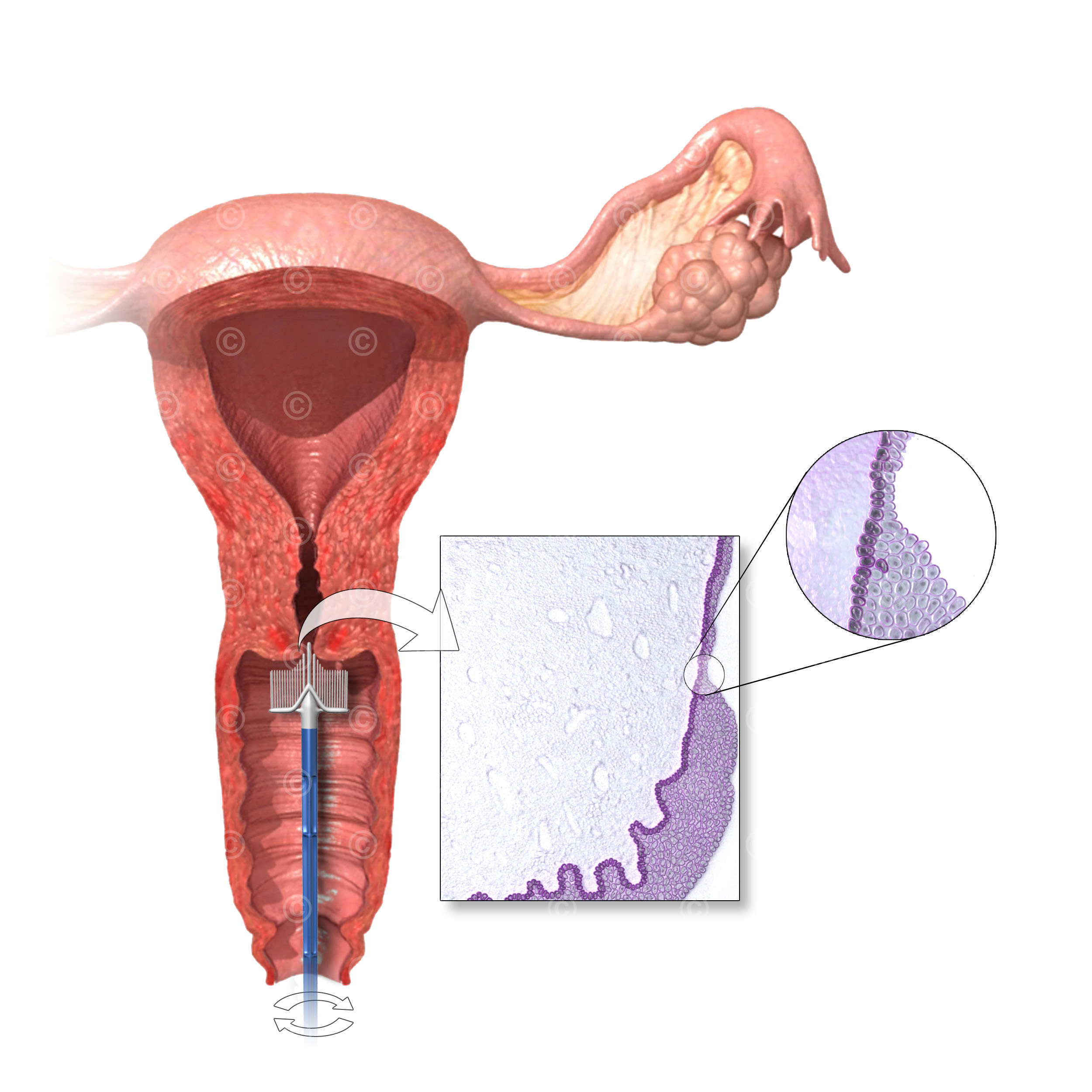 Transformation zone cervix