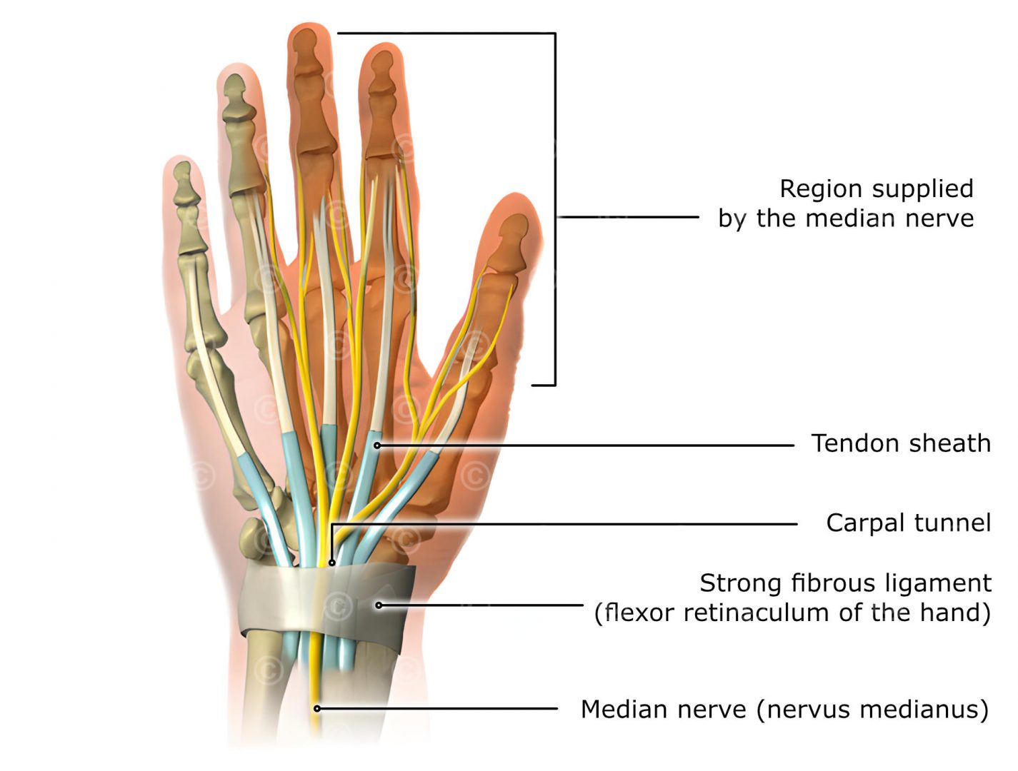 Carpal tunnel syndrome