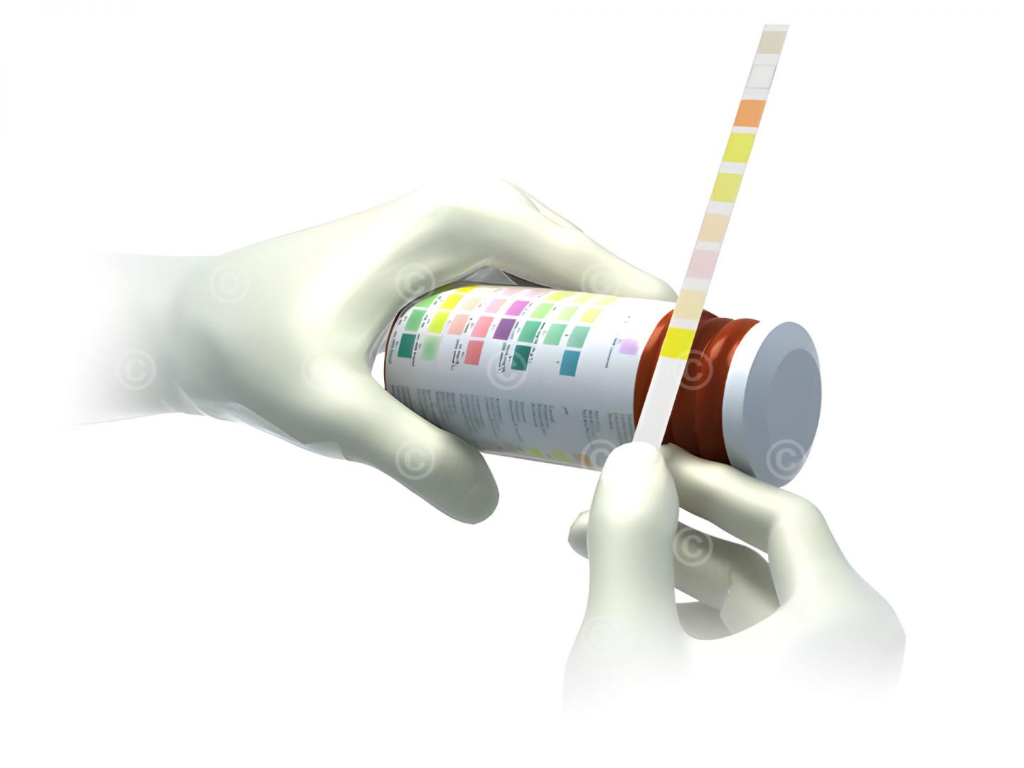 Urinalysis
