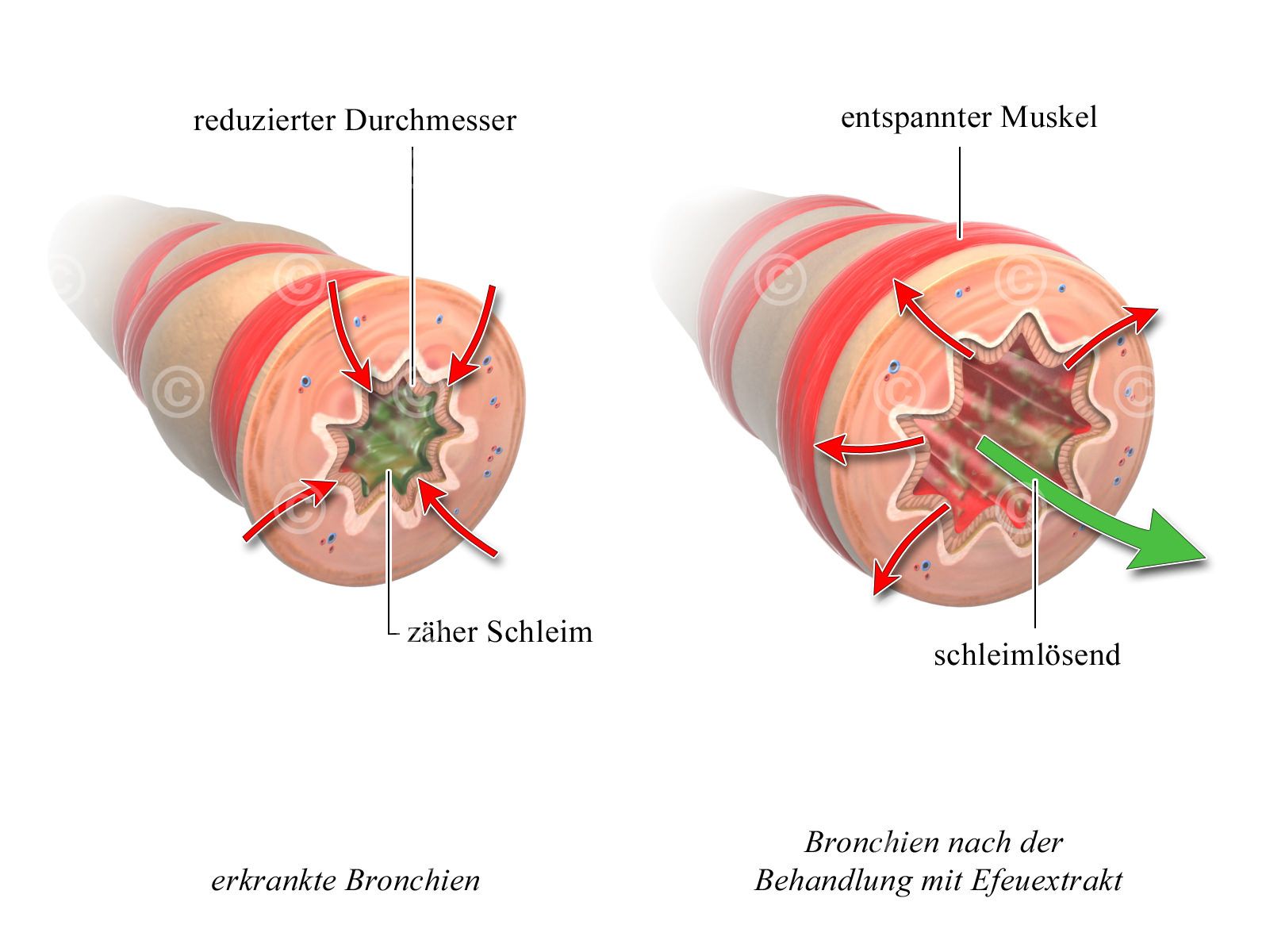 Effects of cold on bronchi