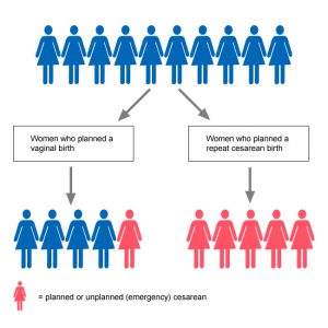 Infographic cesarean