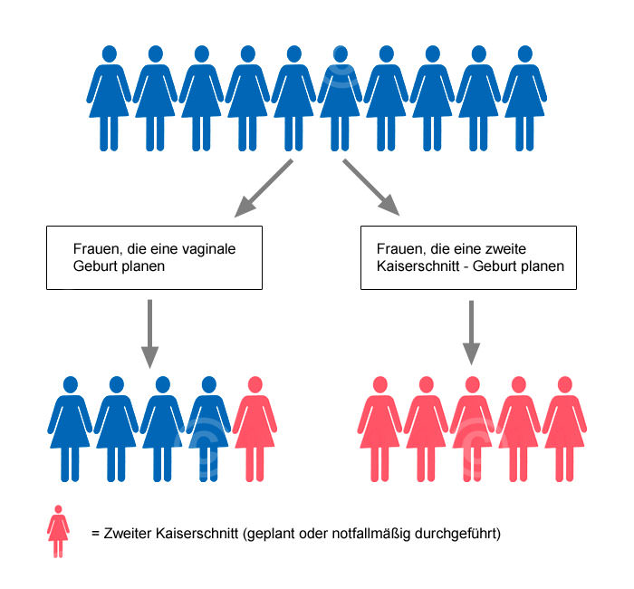 Infografik Kaiserschnitt