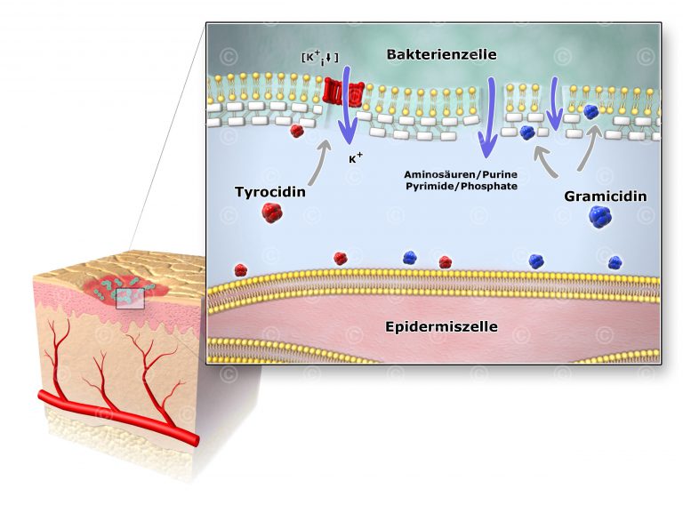 Illustration Wirkung Antibiotika Bakterium - MedicalGraphics