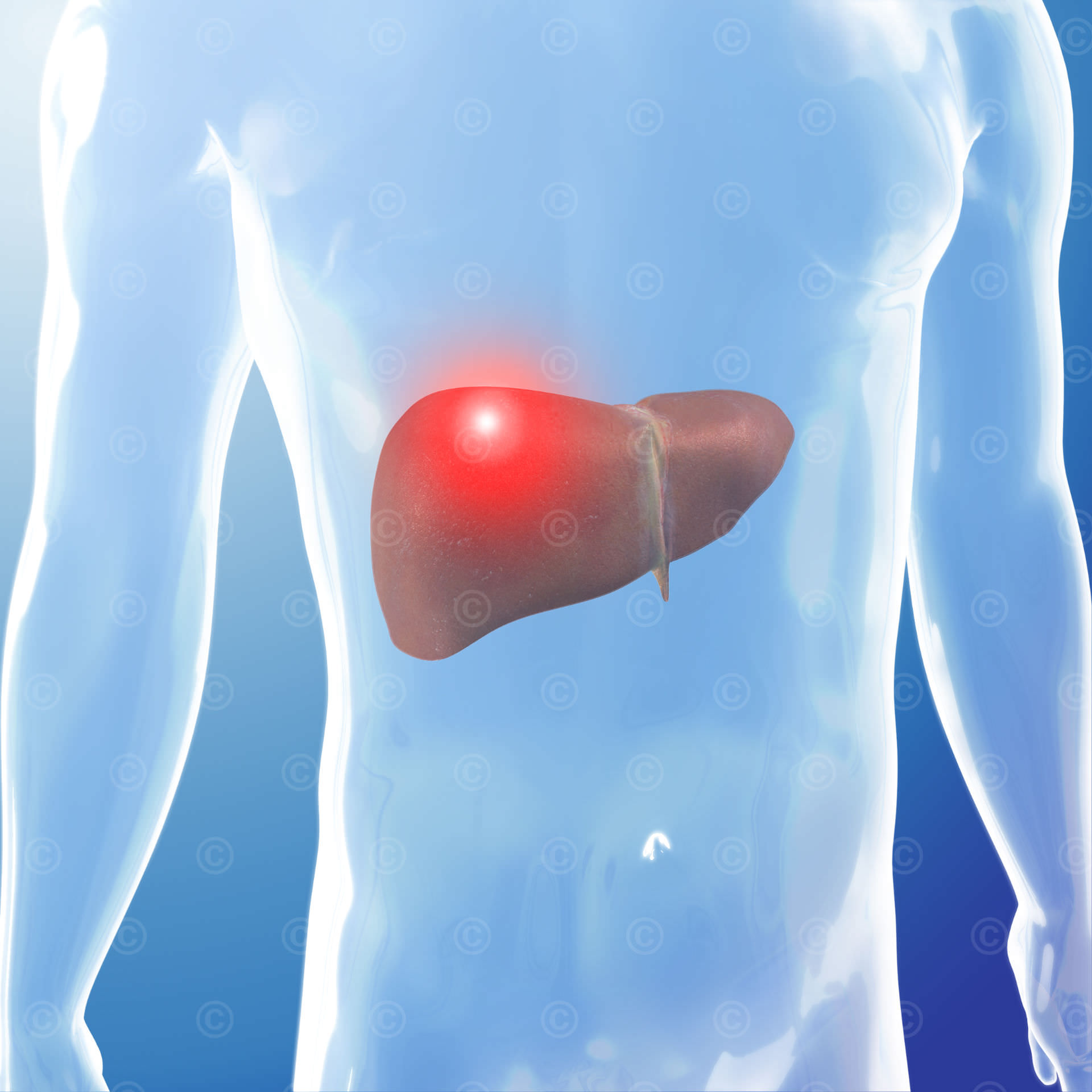 Medizinisches Bild Indikationsgebiet Leberkrebs liver cancer