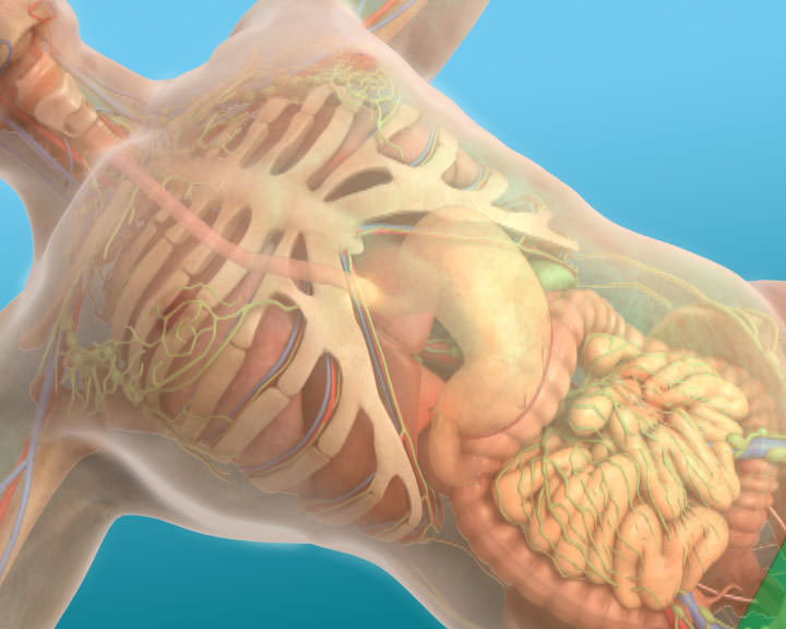 Esophageal carcinoma