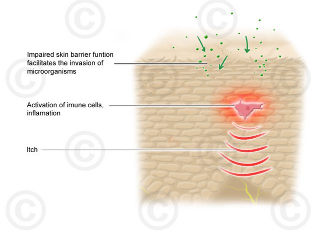 Illustrationen Hautveränderungen Eucerin