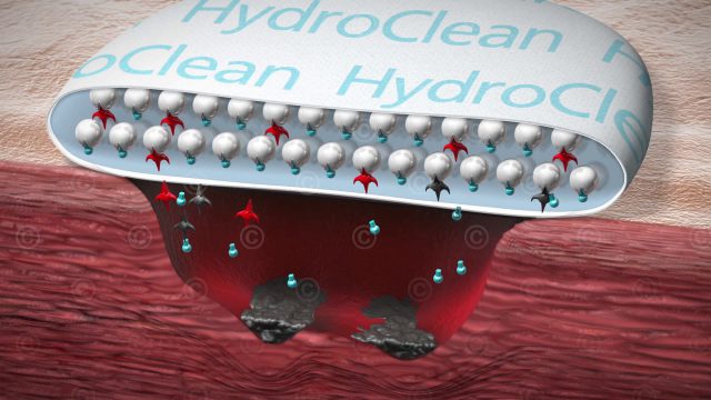 HydroClean wound dressing animation - MedicalGraphics