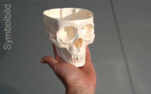 3D model of the bladder of a cat for 3D printer