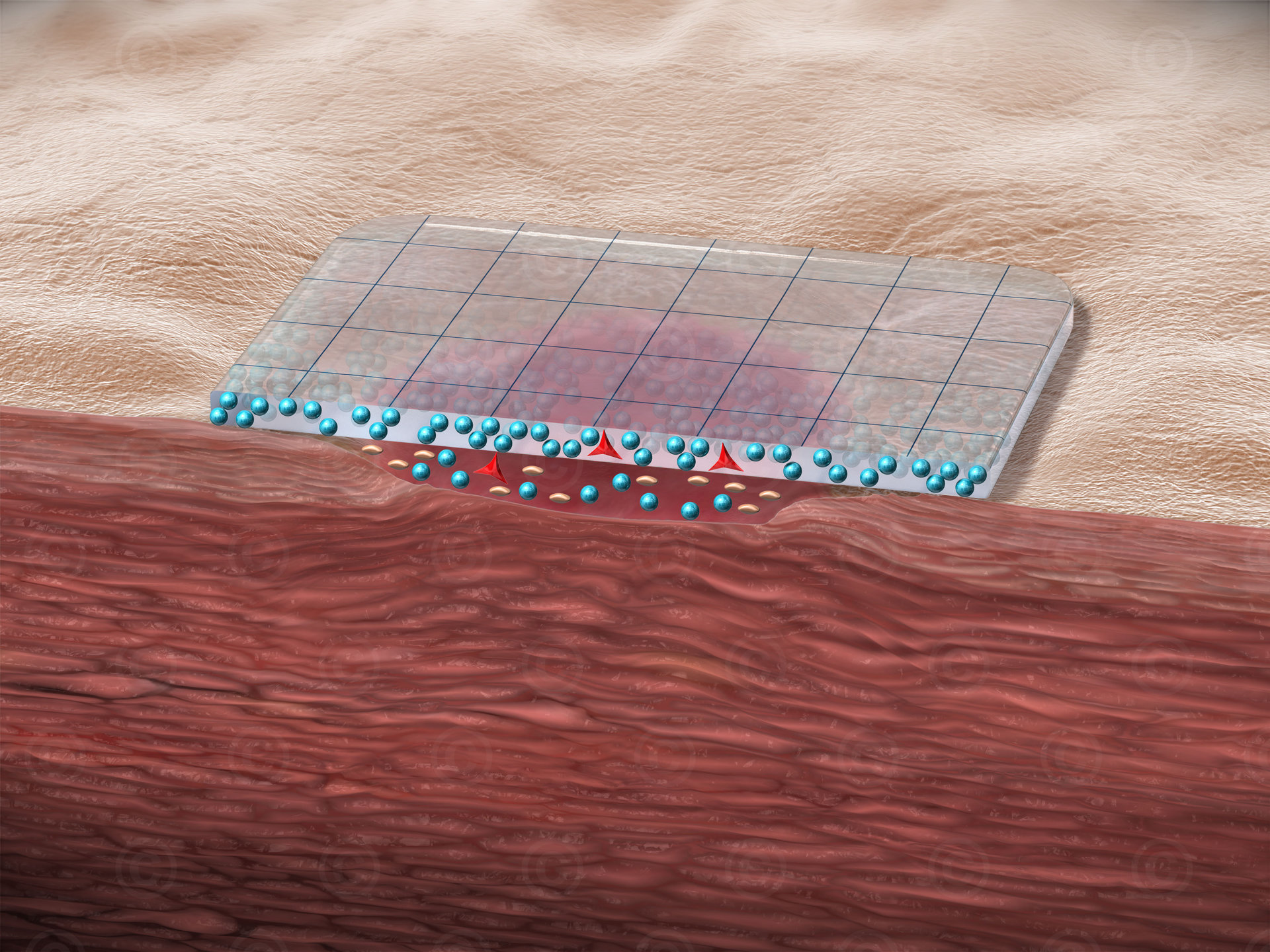 Wound-dressing HydroTac