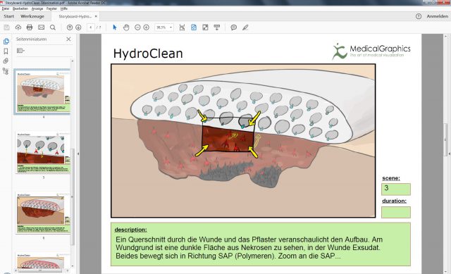 storyboard hydroclean gross