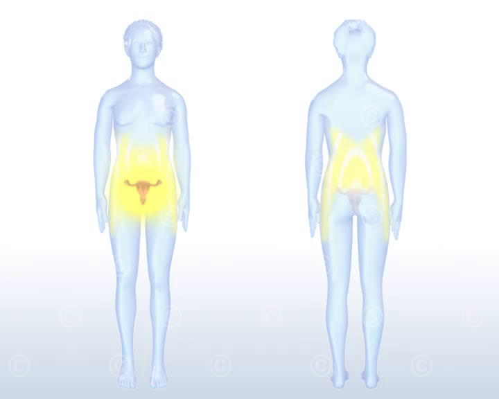 ausstrahlung schmerz endometriose ausstrahlung schmerz endometriose