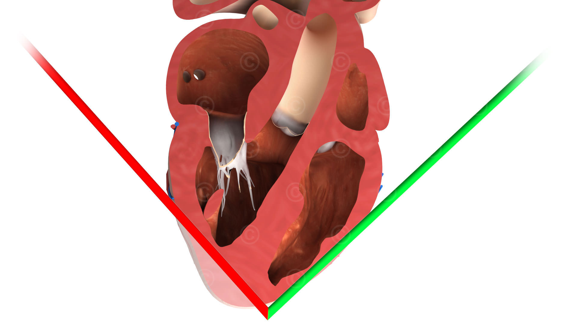 Sonography heart 