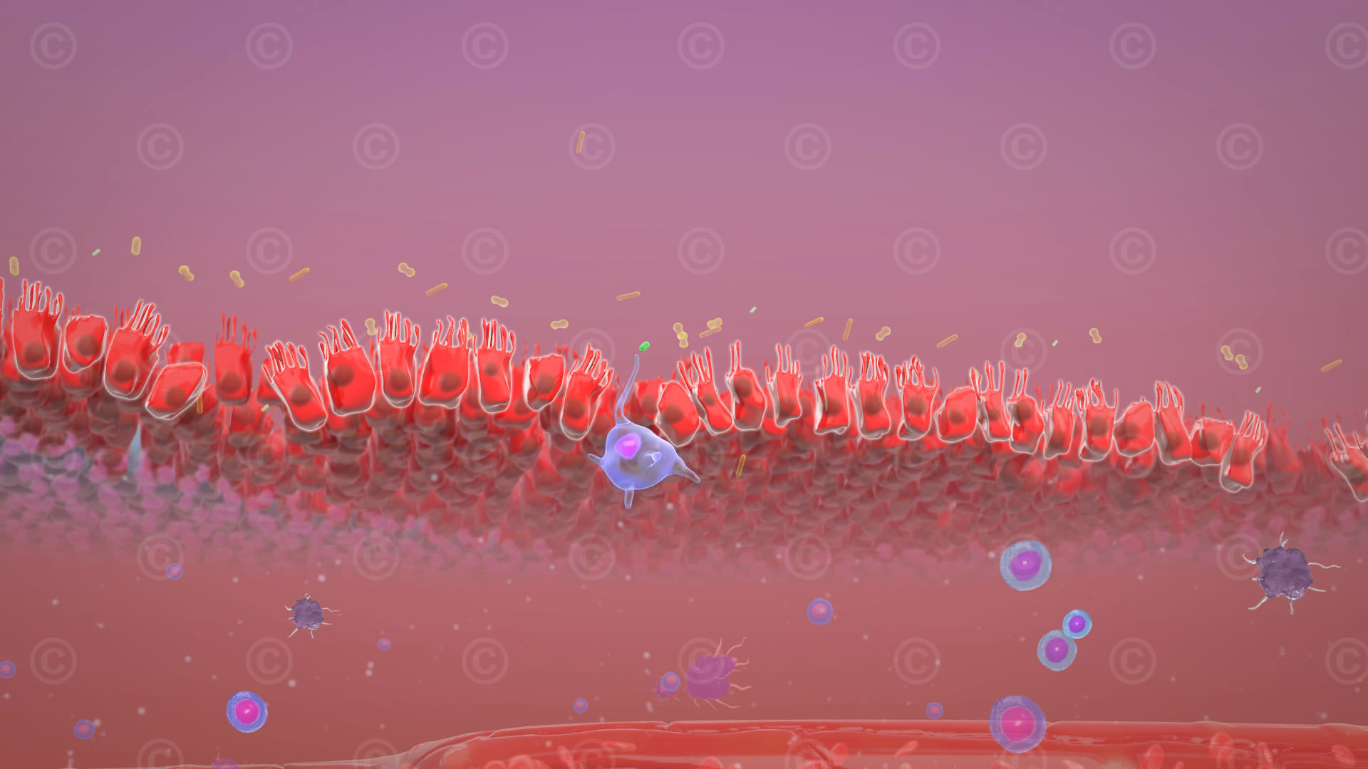 Morbus Crohn Immunreaktion Darmwand