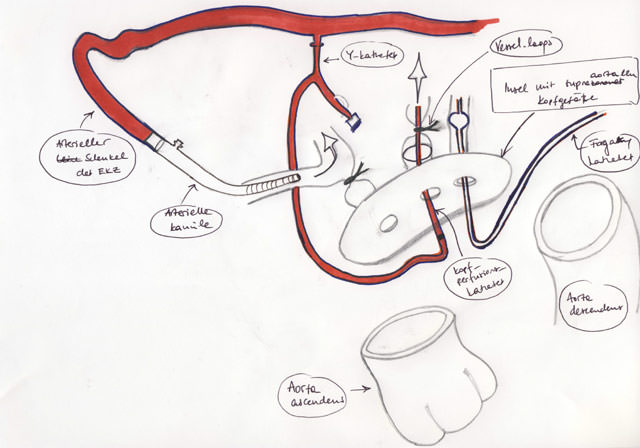 Perfusionsmethode Aorta gross
