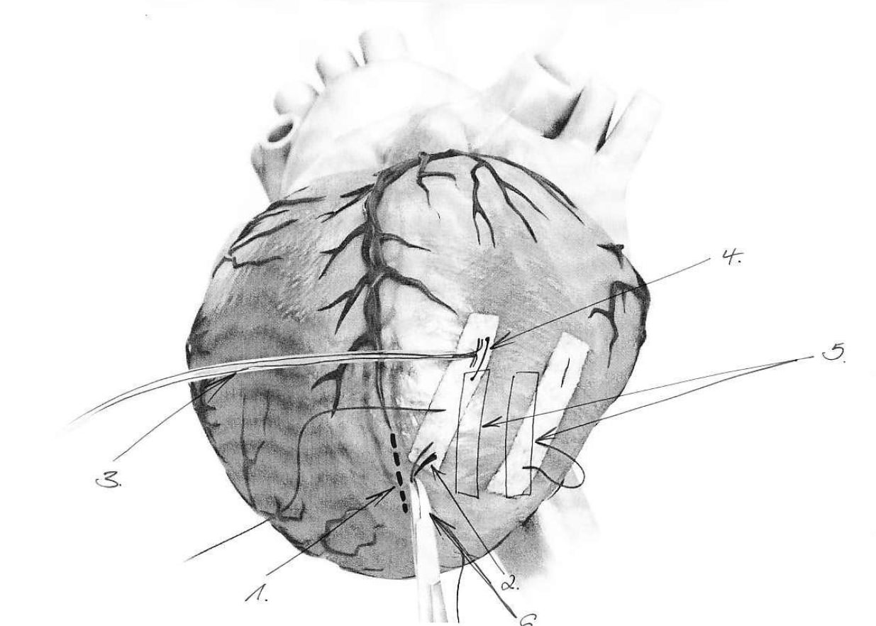 abstimmung illustration gross