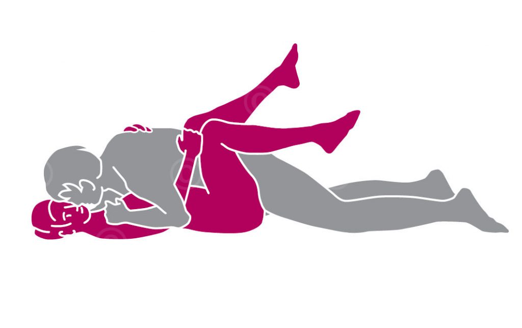 Endoprosthetics - sexuality