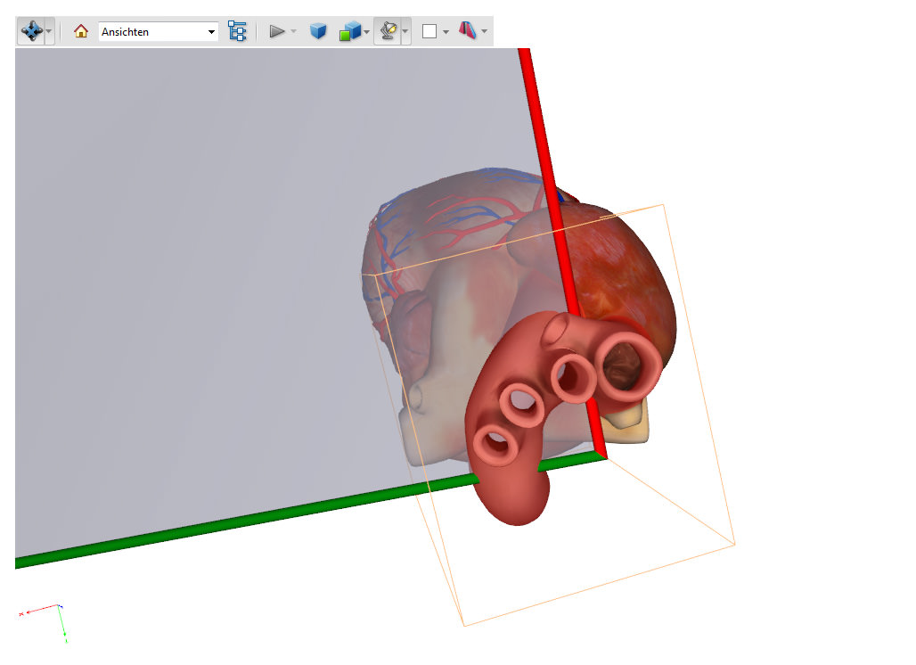 3d pdf Aortic Arch LAX gross