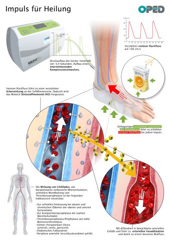 Infografik zu Kompression-Therapie bei Gefäßerkrankungen
