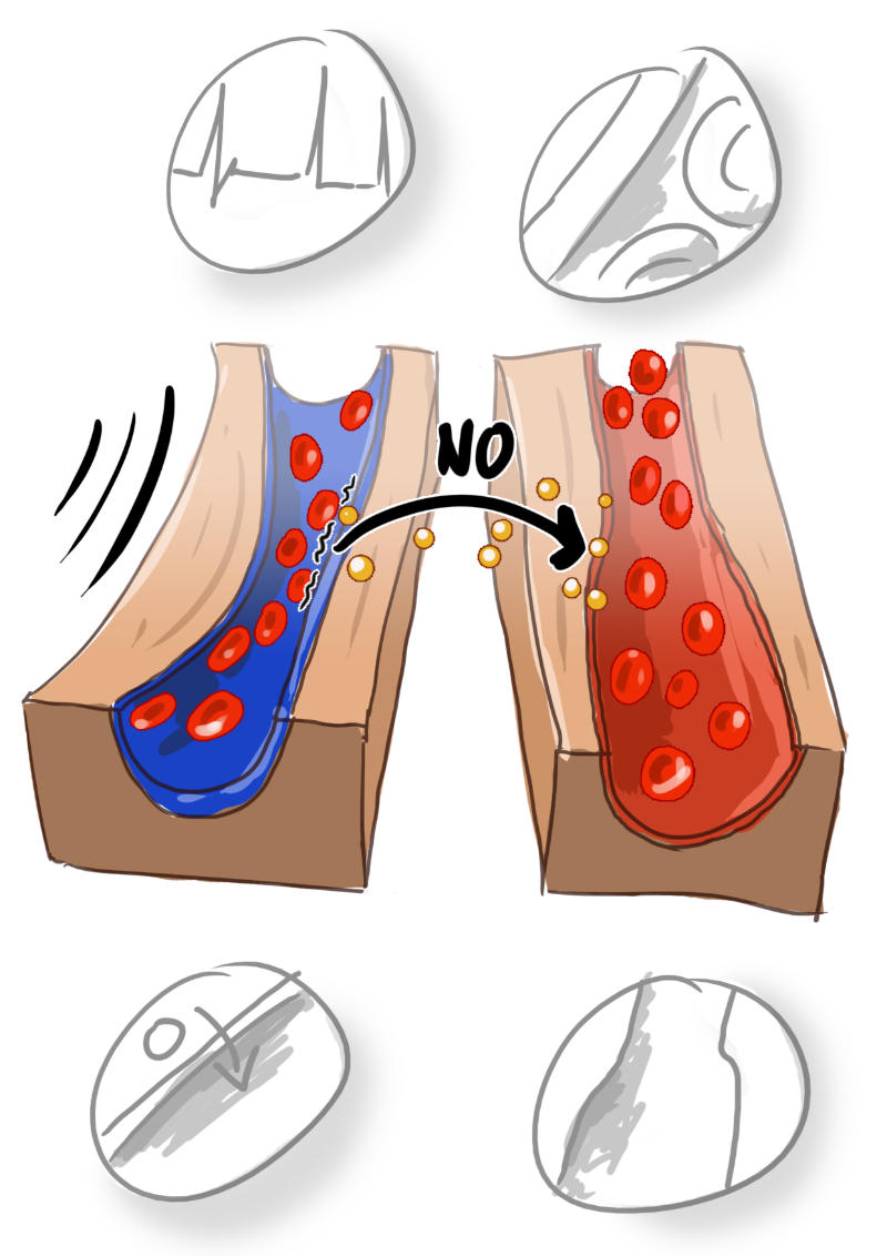 infografik skizze01 venen no arterien