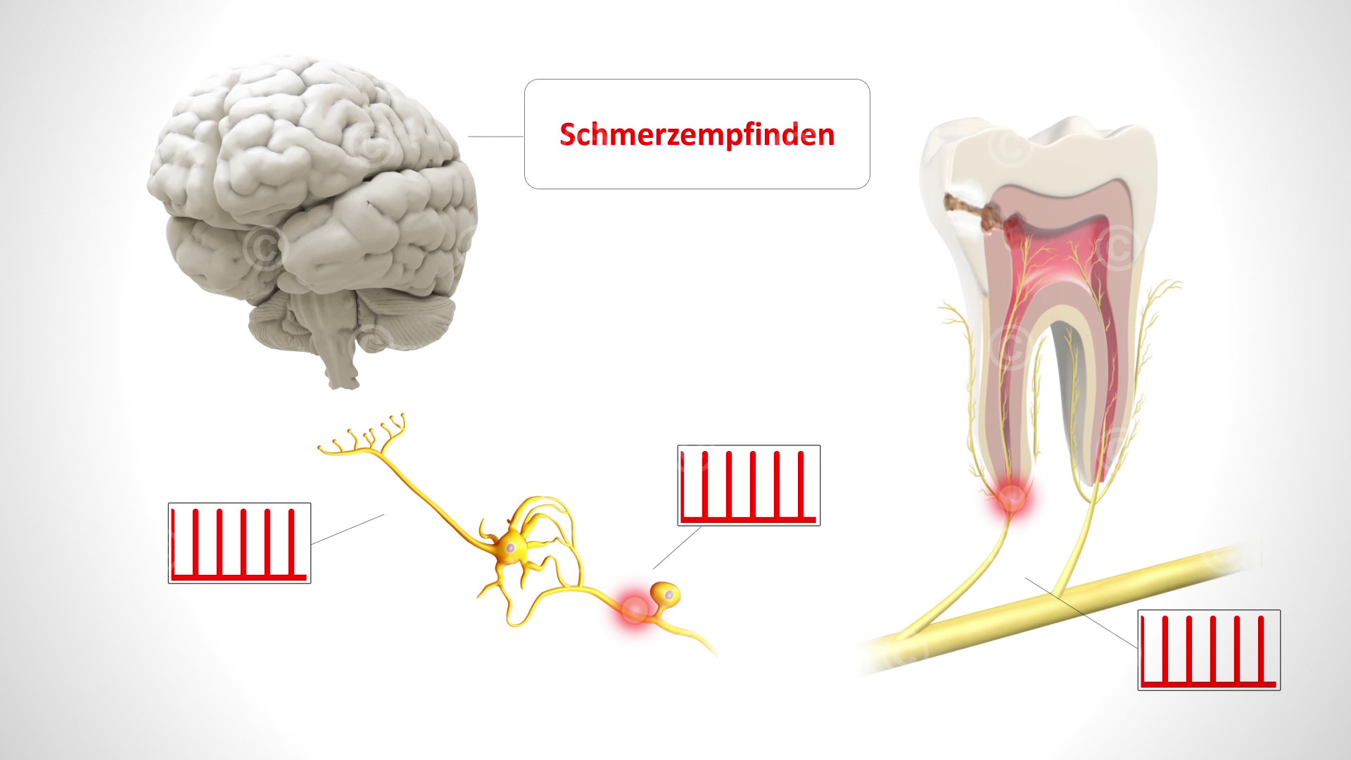 schmerzempfinden akut pulpitis