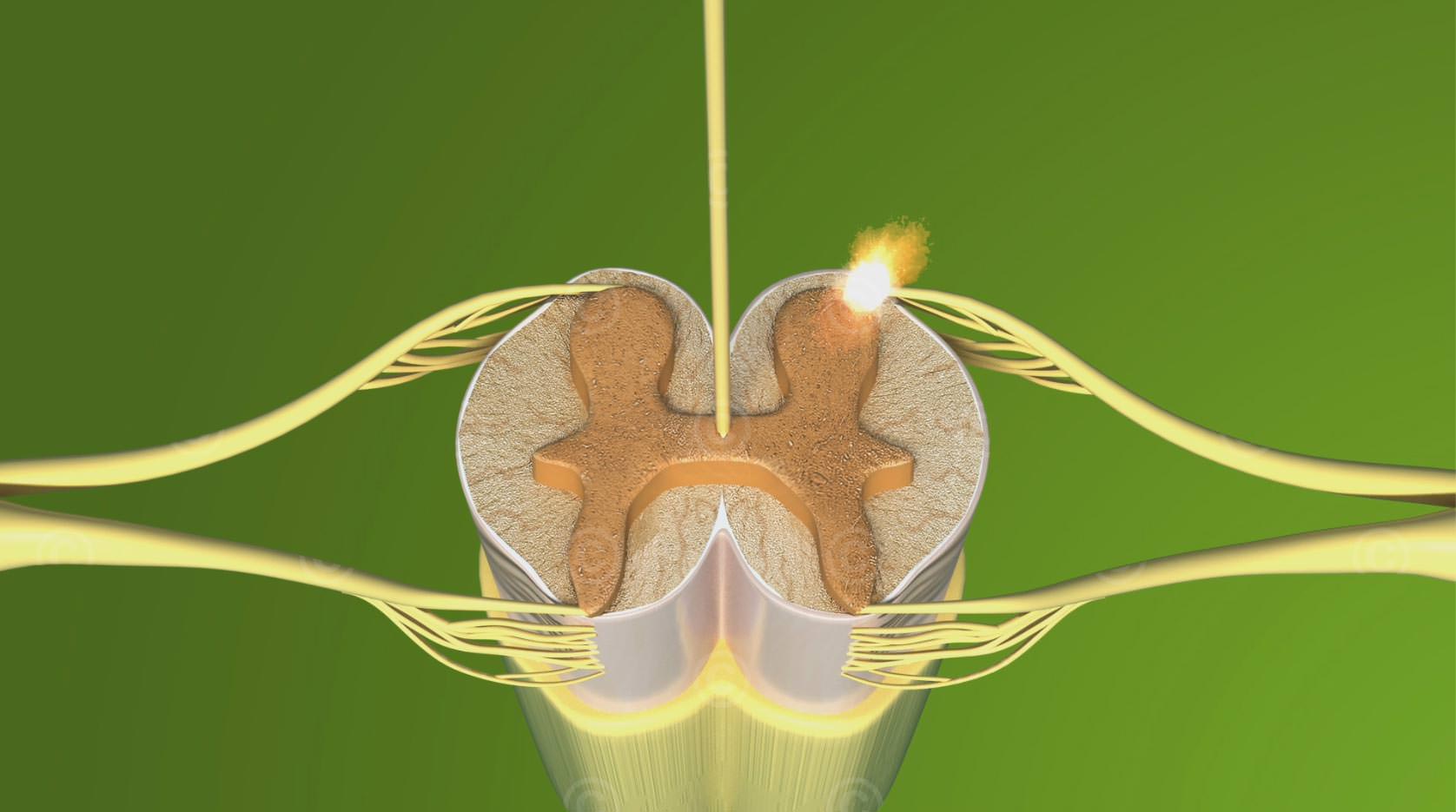 Efferent stimulation conduction