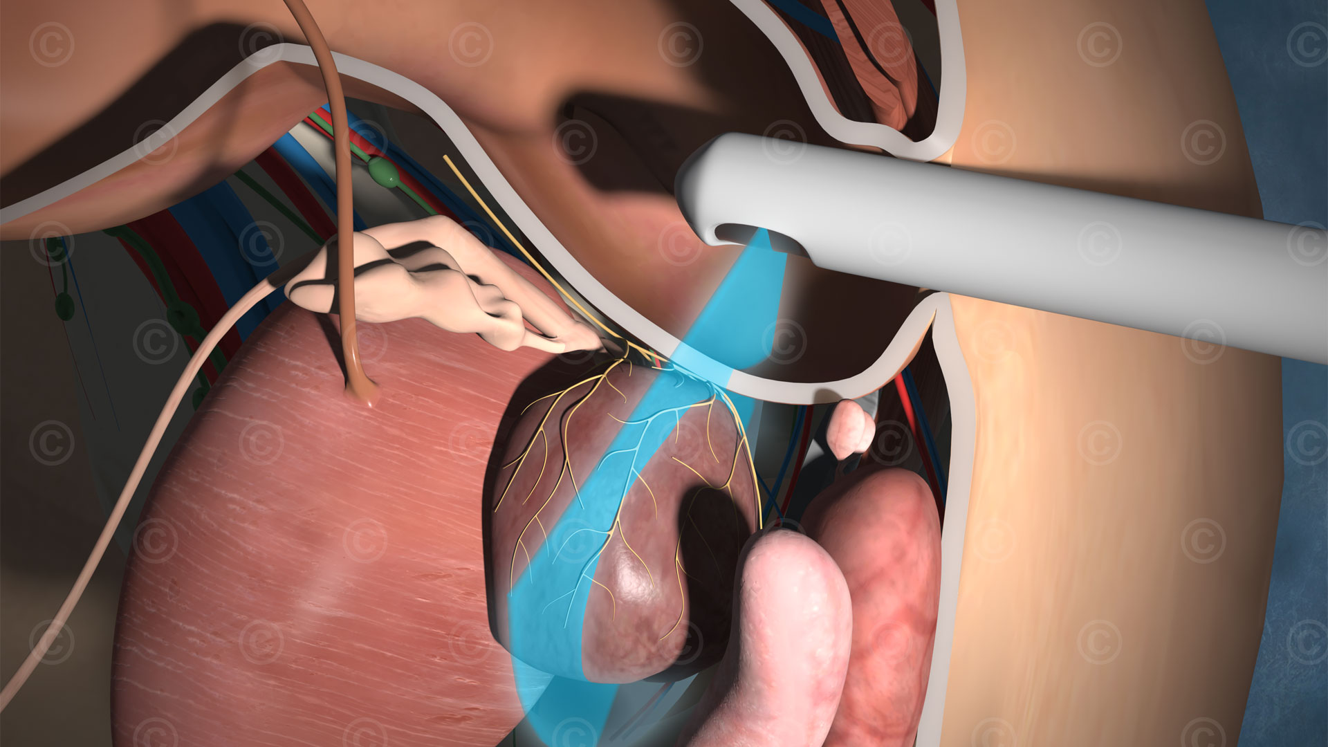 Prostate ultrasound examination