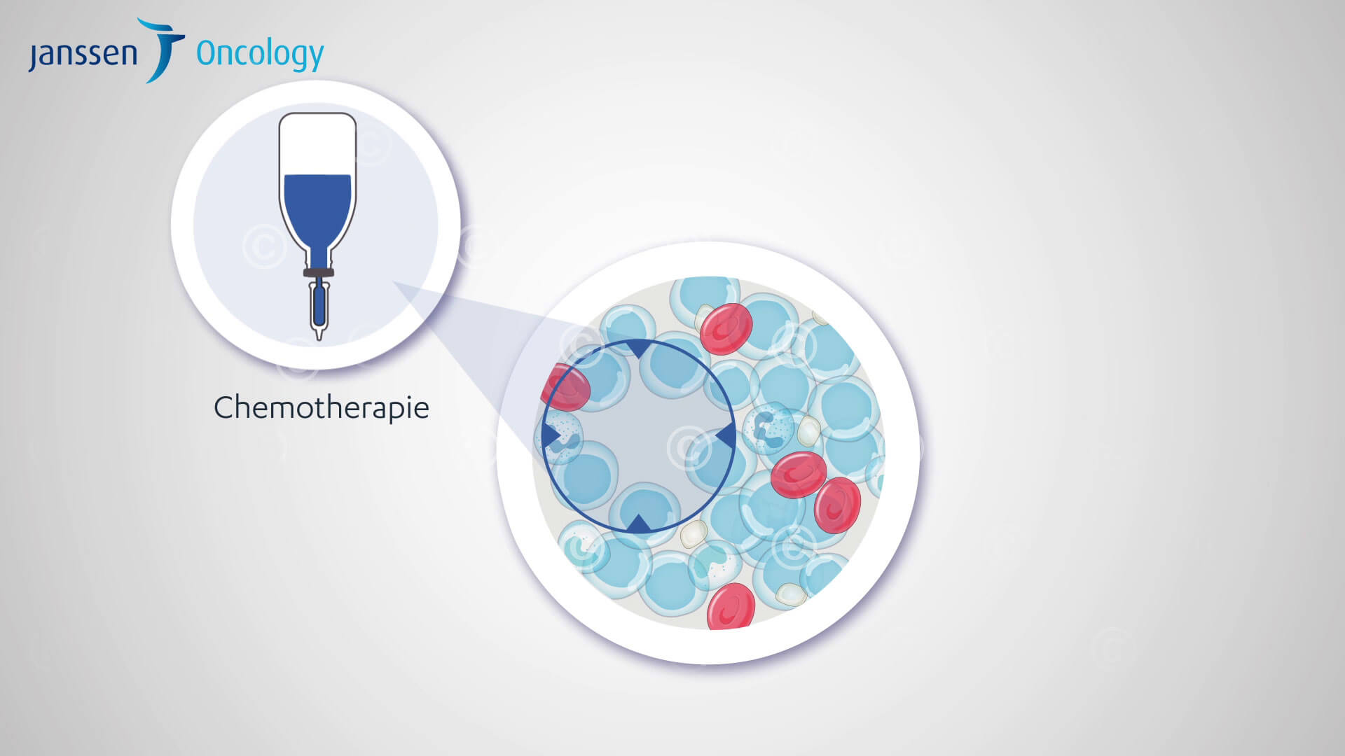Illustration Wirkung einer Chemotherapie auf das Blutbild Illustration effect of chemotherapy on blood count