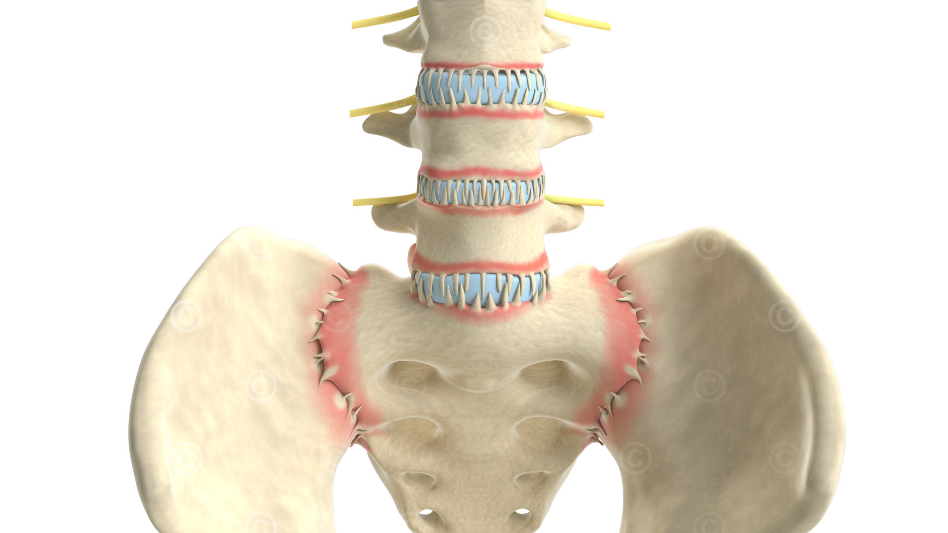 Enthesitis spine