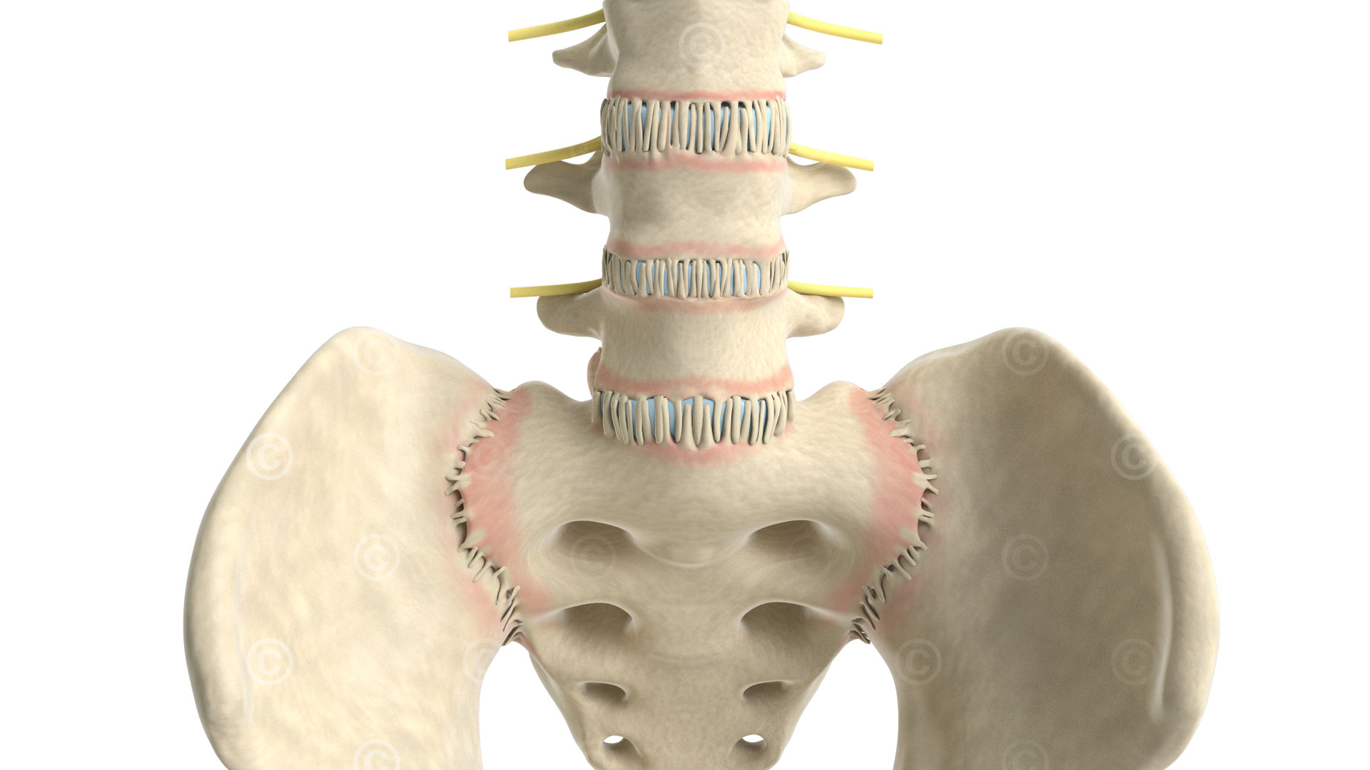 Alteration of the vertebral junctions and hips as a result of enthesitis disease