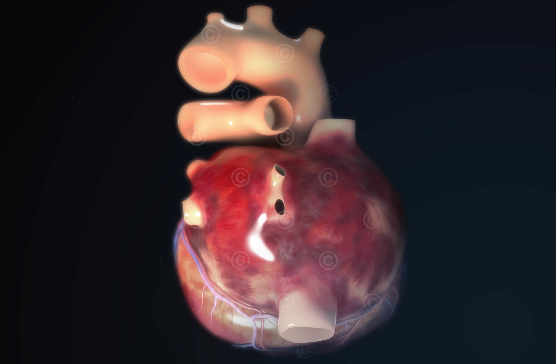Heart behind atria pulmonary veins vena cava