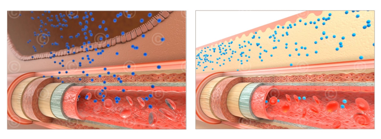 Transdermal administration drug