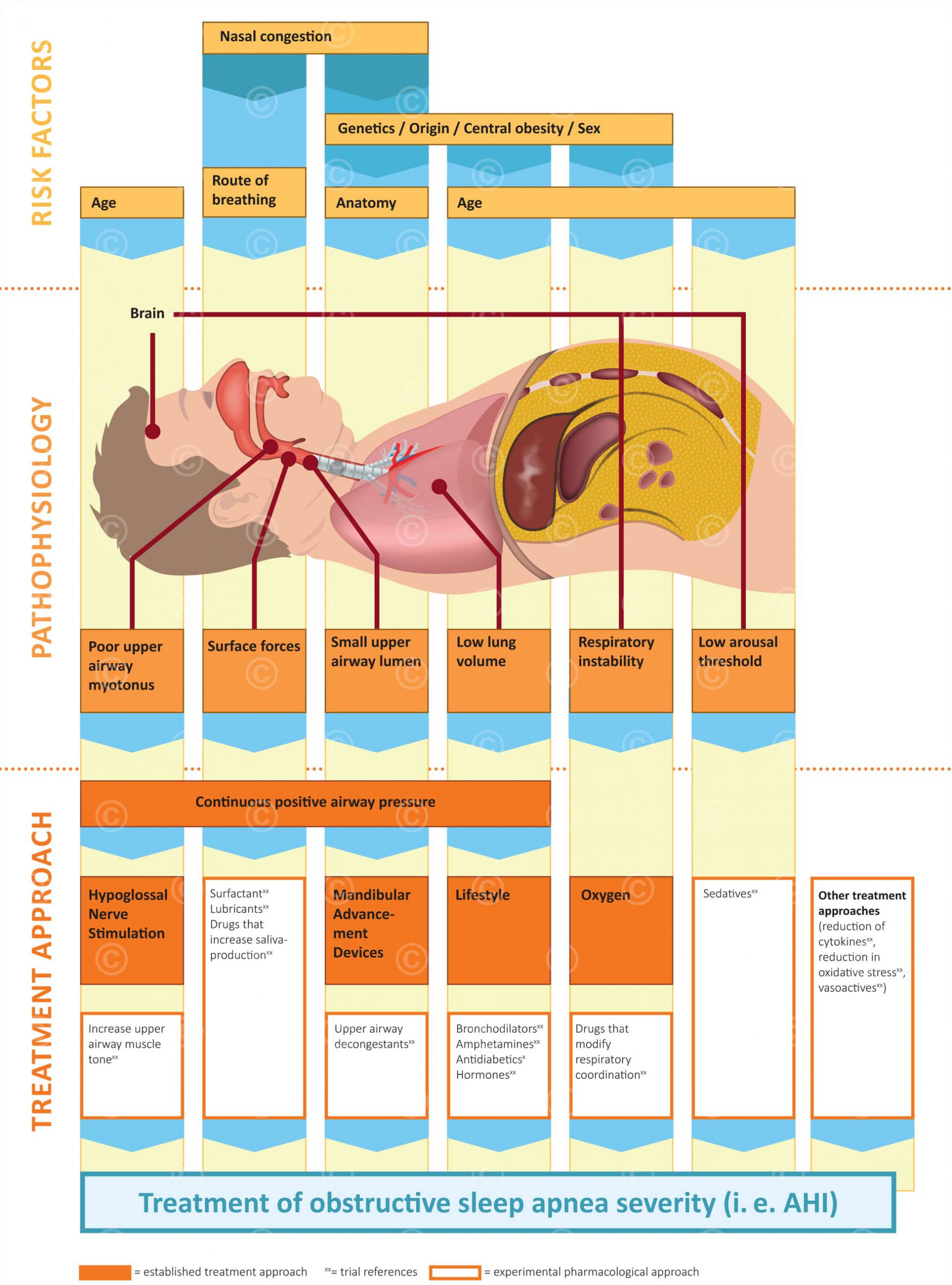 Grafik Schlafapnoe MedicalGraphics