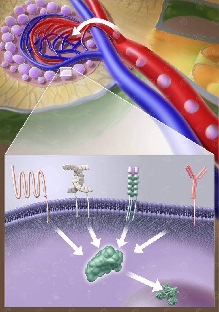 CLL Lymphknoten