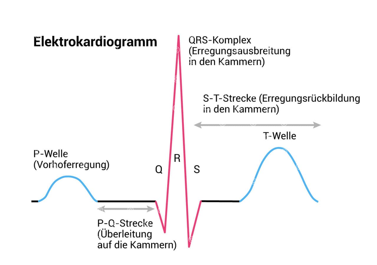 ekg elektrokardiogramm