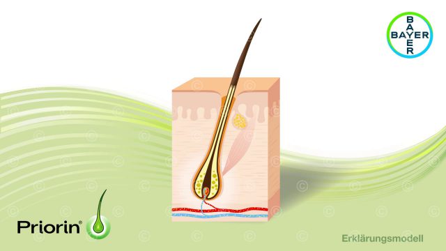Animation hair loss treatment