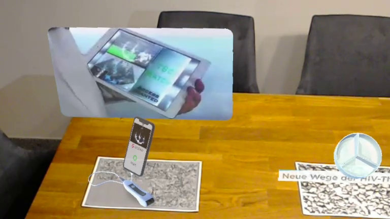 hololens - AI-supported tuberculosis diagnosis