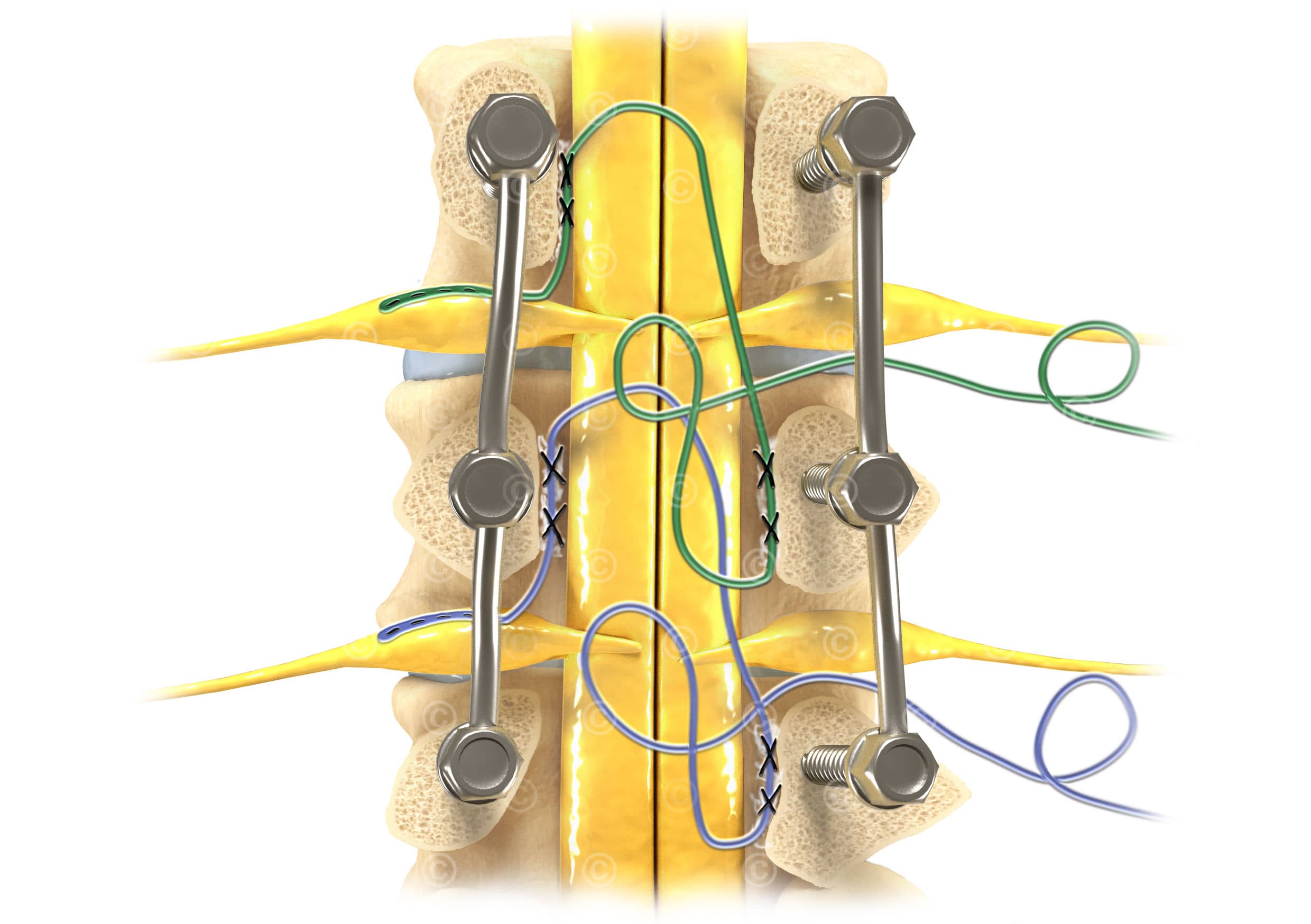 Illustrationen DRG-Stimulation