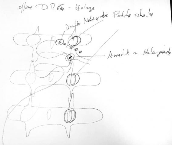 Illustrations DRG stimulation - MedicalGraphics