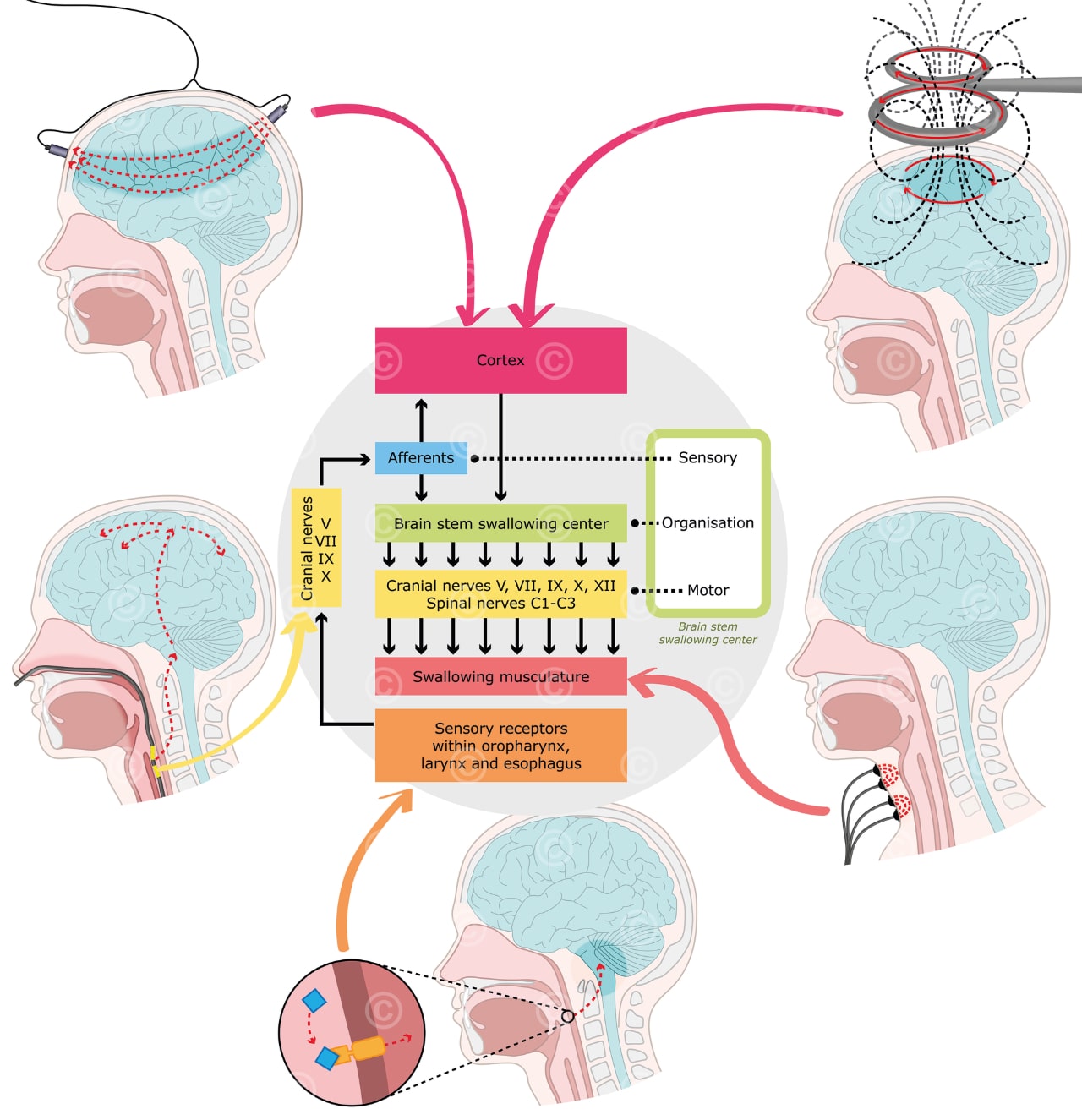 Treatment options for dysphagia