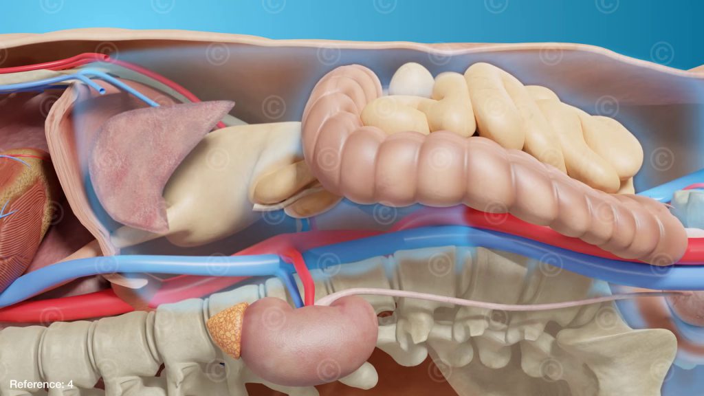 Fluid retention abdomen