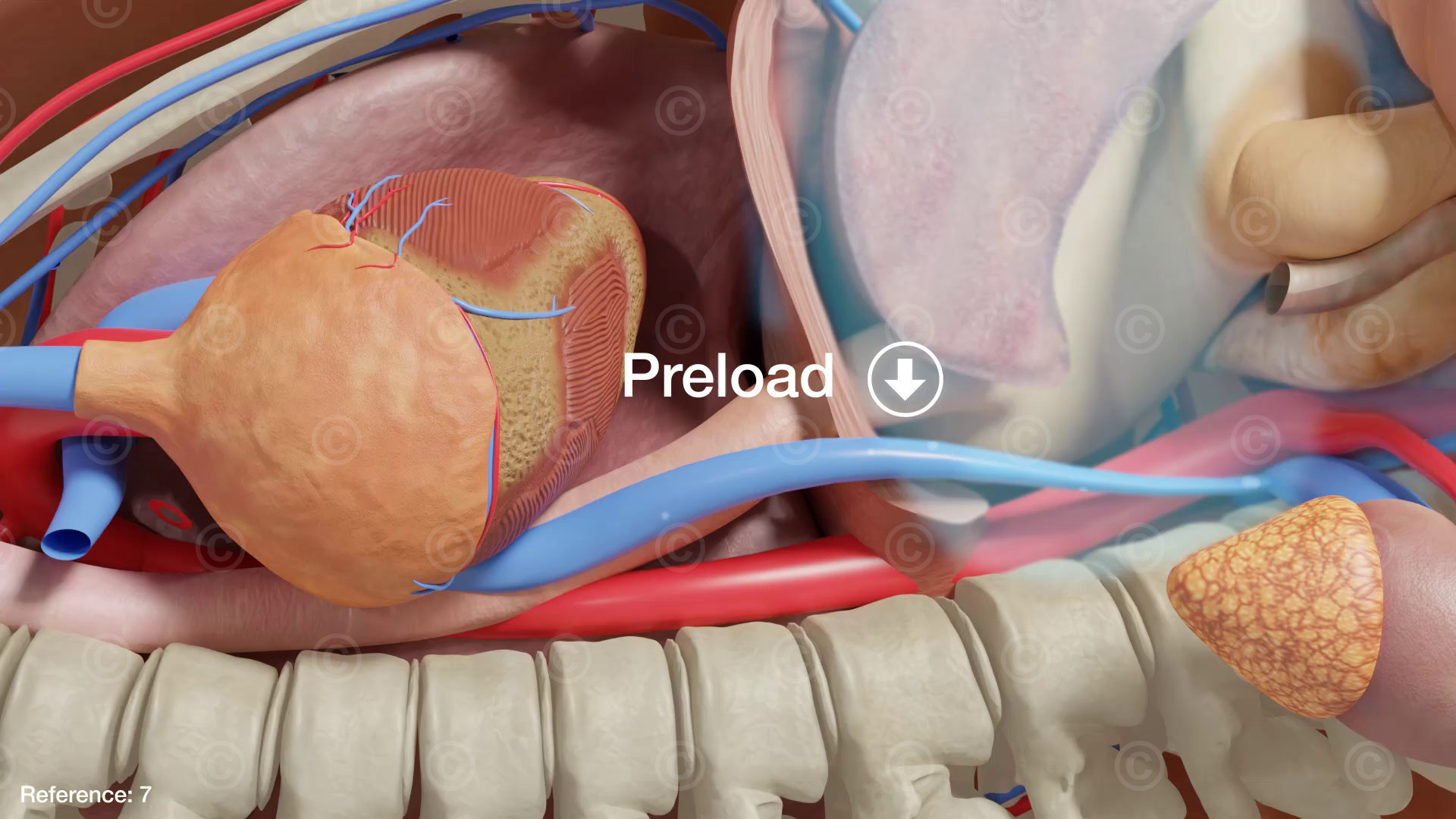 Reduced pre-load, i.e. less incoming blood to the heart