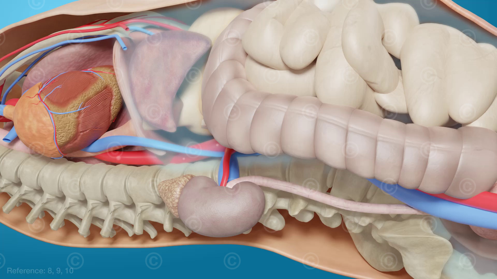 Undersupply of kidneys and intestines