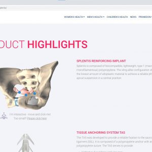 3D web application gynecology