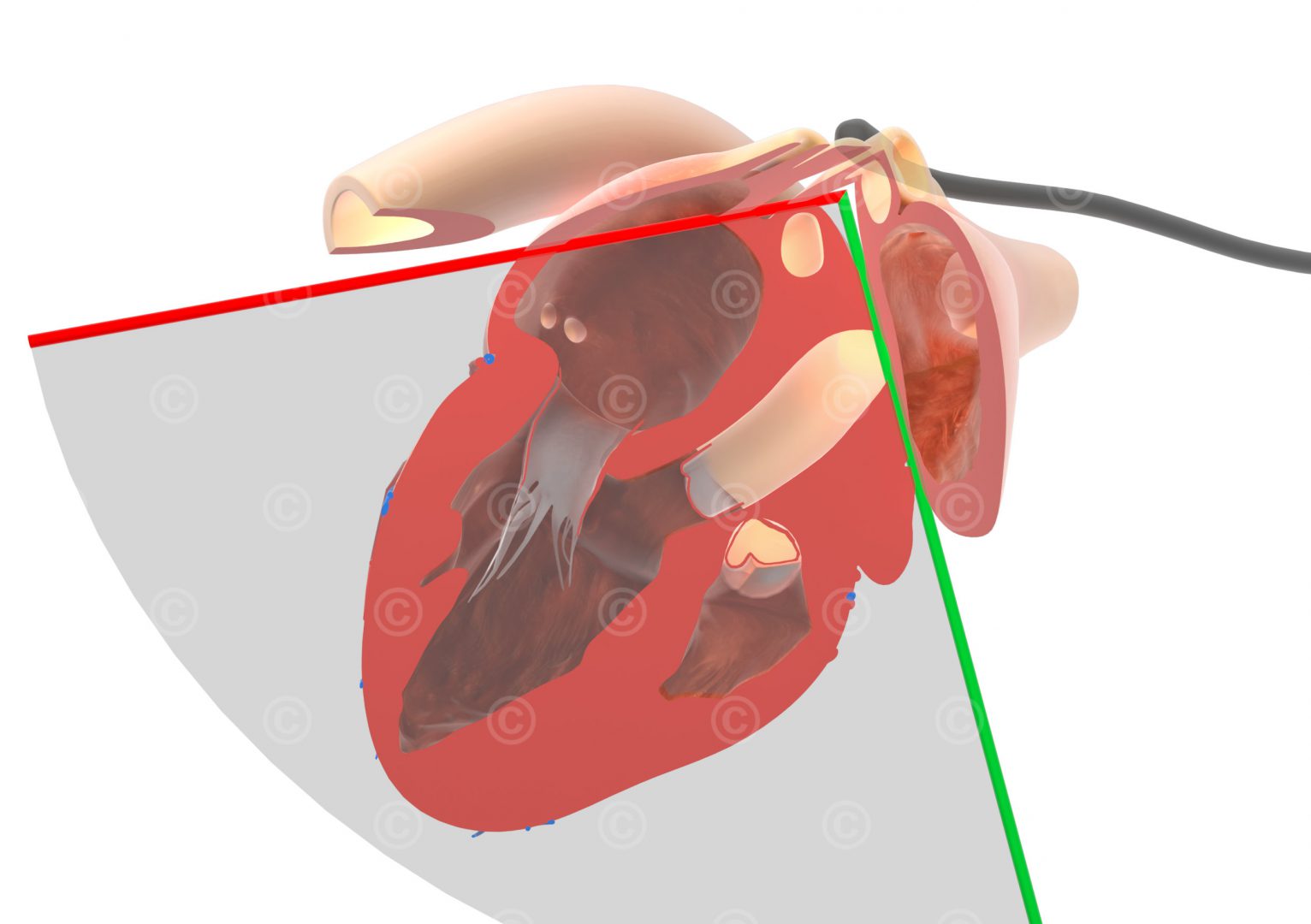 Illustration MELAX Transösophageale Echokardiographie MedicalGraphics